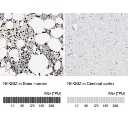 IKB zeta Antibody, Novus Biologicals 25 &mu;L; Unlabeled:Antibodies, Polyclonal